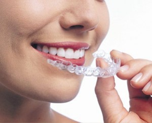 six month smiles your specialised orthodontist treatments in Cavan with Cavan Braces